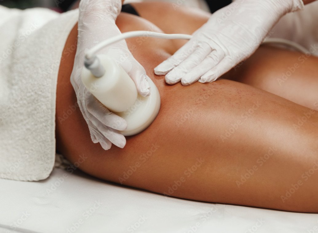 cavitation